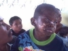 db_may_03_2009_-_skin_disease__child_1